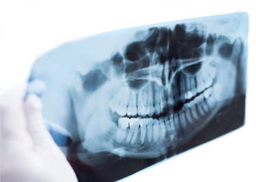 Dentascan Cone Beam 3D