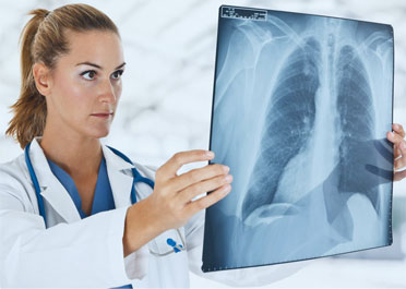Radiologia Digitale